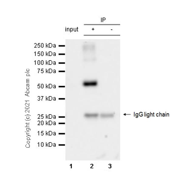 Anti-TPH2 antibody [EPR25100-29] - BSA and Azide free(AB288068)