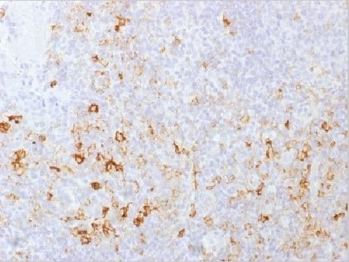 Psgl 1 Antibody Psgl1 1601 Ab218518  Immunohistochemistry Formalin Pfa Fixed Paraffin Embedded Sections Img12903