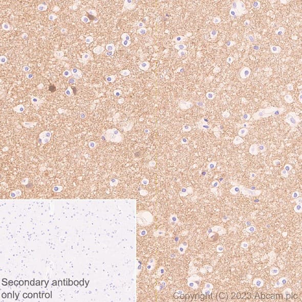 Anti-beta Synuclein antibody [EP1537Y] - BSA and Azide free(AB221908)