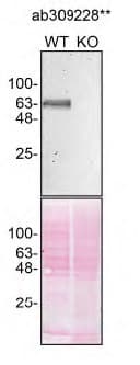 Anti-GBA antibody [EPR26755-29] - BSA and Azide free (Capture)(ab309228)