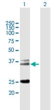 Anti-TCR alpha antibody(AB167645)