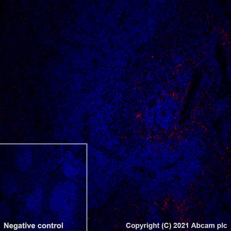 Alexa Fluor 647 Pf4 Antibody Epr7763 Ab280969  Immunohistochemistry Formalin Pfa Fixed Paraffin Embedded Sections Img94874