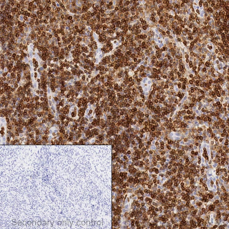 Anti-Bcl-2 antibody [EPR17509](AB182858)