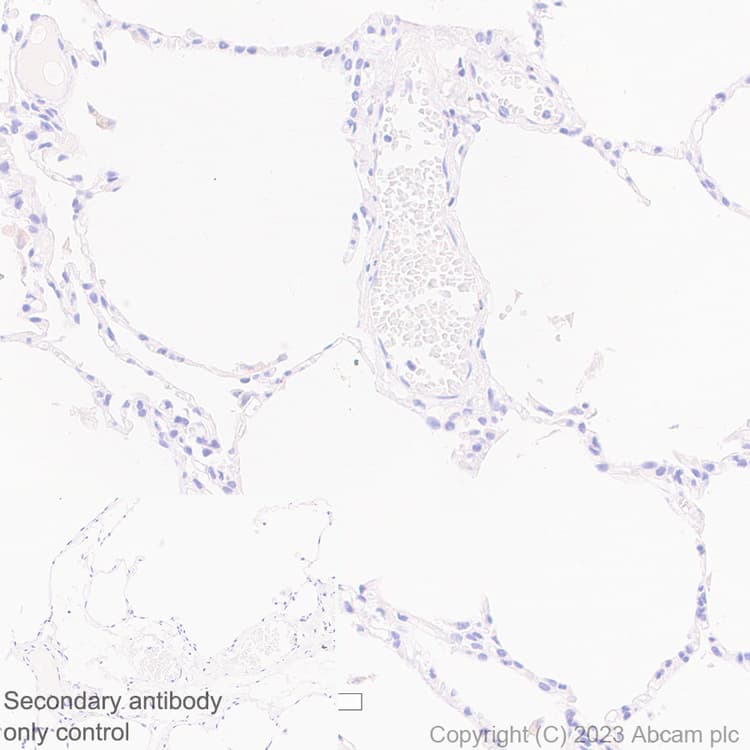 B4galnt1 Antibody Epr28064 64 Ab314130  Immunohistochemistry Formalin Pfa Fixed Paraffin Embedded Sections Img420038