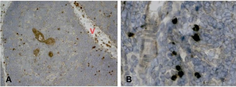 Anti-Mast Cell Tryptase antibody [AA1](ab2378)