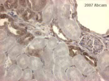 Anti-IKB alpha antibody [E130] - BSA and Azide free(AB215972)