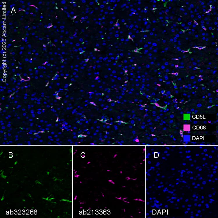 Anti-CD68 antibody [EPR20545](AB213363)