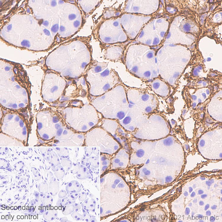 Anti-Collagen I antibody [EPR24331-53](AB270993)