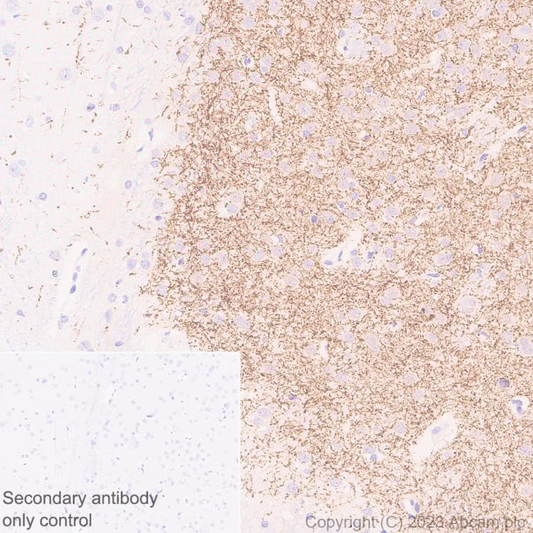 Anti-Tyrosine Hydroxylase antibody [RM1085](AB315252)