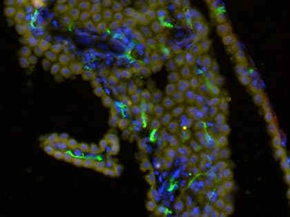 Anti-TMEM119 antibody [28-3] - Microglial marker(AB209064)