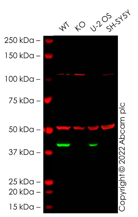 Anti-alpha Tubulin antibody [EP1332Y] - Microtubule Marker(AB52866)