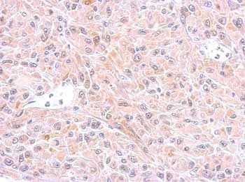 Anti-GST3 / GST pi antibody(AB153949)