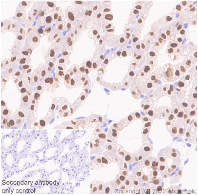 Anti-GATA3 antibody [EPR16651] - ChIP Grade(AB199428)