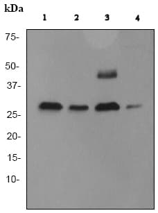 Anti-Cathepsin D antibody [EPR3057Y](ab75852)