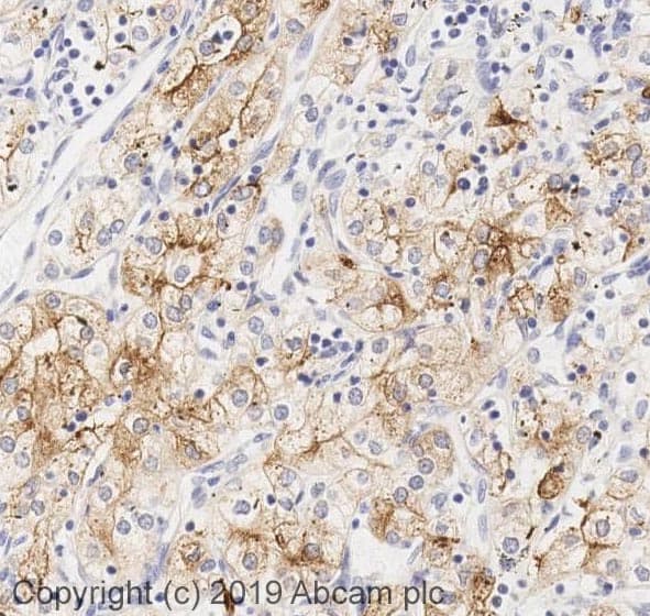 Anti-Lrp2 / Megalin antibody(AB76969)