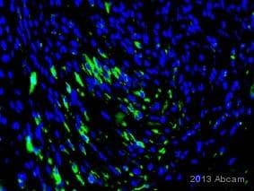 Anti-mCherry antibody [1C51](AB125096)