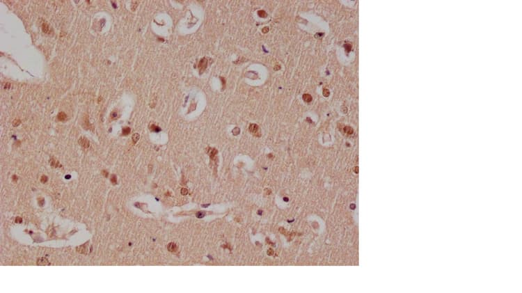 E2f4 Antibody 24e12 Ab314180  Immunohistochemistry Formalin Pfa Fixed Paraffin Embedded Sections Img420317