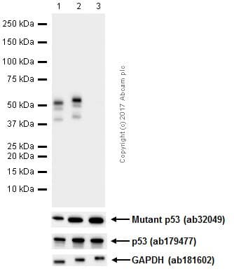 Anti-p53 (phospho S392) antibody [EP155Y] - BSA and Azide free(ab239211)