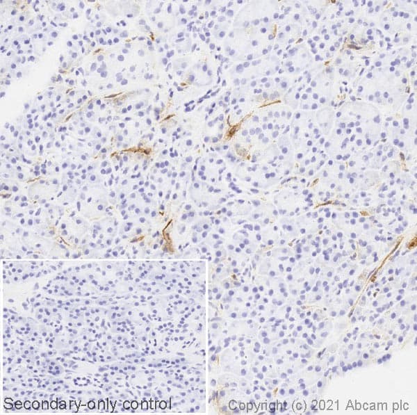 Cd39 Antibody Ac2 Ab97552  Immunohistochemistry Frozen Sections Img180033
