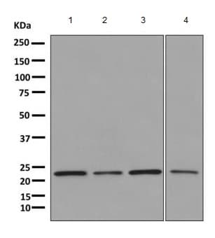Proteasome Subunit Beta Type 2 Psmb2 Antibody Epr88262b Bsa And Azide Free Ab249366  Western Blot Img124018
