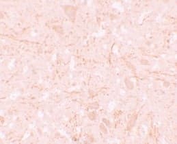 Anti-NALP12/NLRP12 antibody(AB105409)