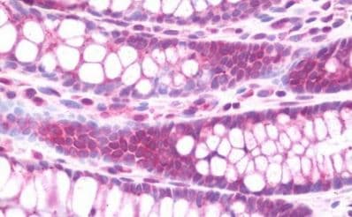 Anti-Claudin 8 antibody(AB211439)