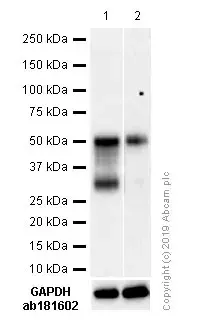 Anti-PAX8 antibody [SP348] - N-terminal(AB227707)