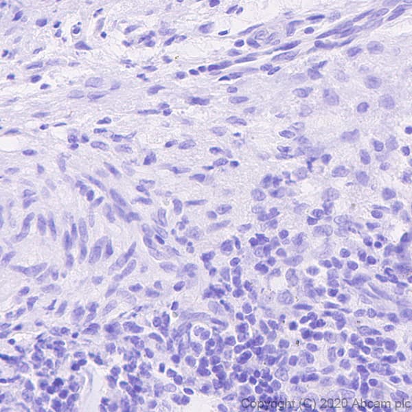 Human Histone H3.3 (Mutated G34W, G34V, G34R) Antibody Panel(AB274410)