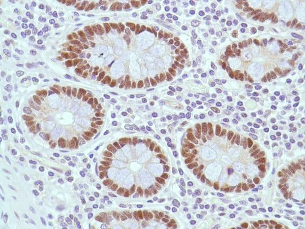 Anti-MSH2 antibody [SP46](AB231437)