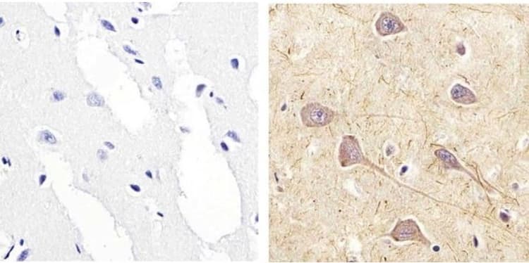 Rsk1 P90 Phospho S221 Antibody Ab10695  Immunohistochemistry Formalin Pfa Fixed Paraffin Embedded Sections Img181592