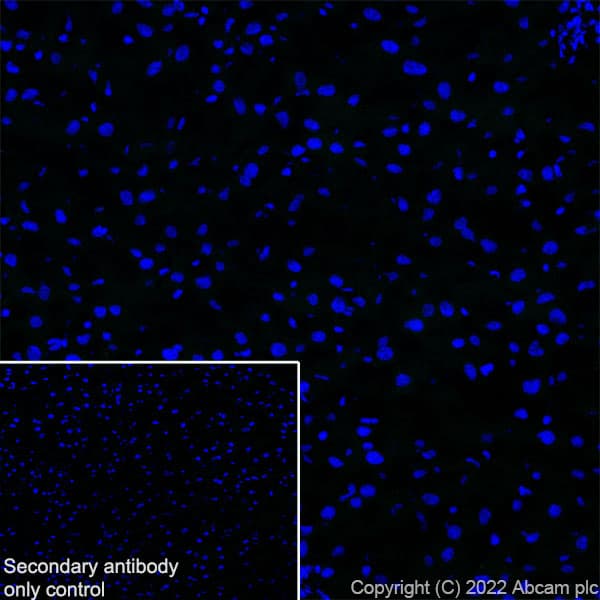 Anti-Bassoon/BSN antibody [L124-59](AB306593)