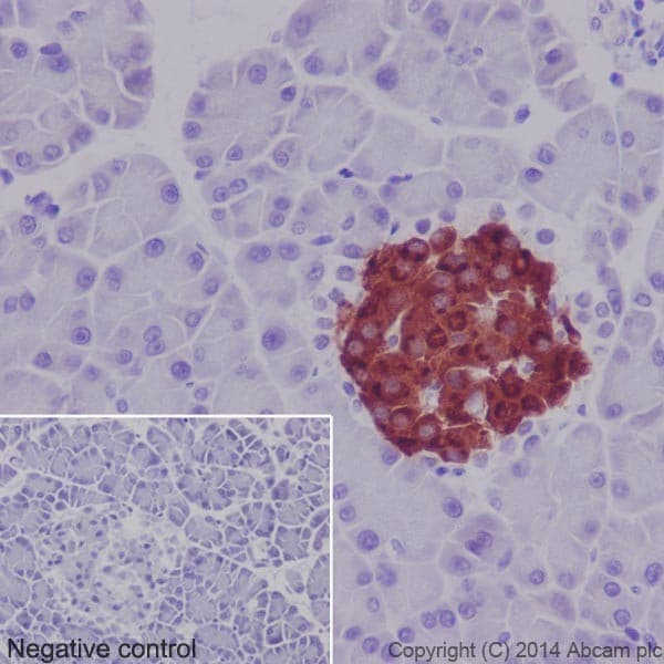 Anti-Insulin antibody [EPR17359](AB181547)