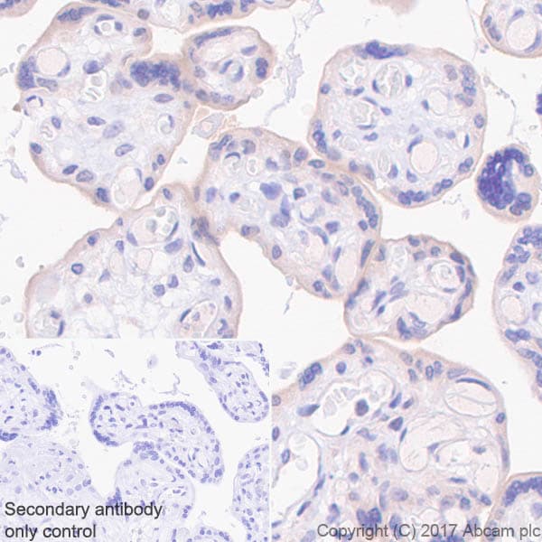 Anti-BCRP/ABCG2 antibody [EPR21122](AB229193)