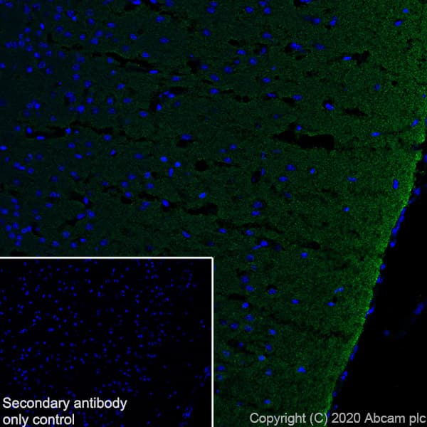 Anti-Synapsin I antibody [EPR23531-50] - Synaptic Marker(AB254349)