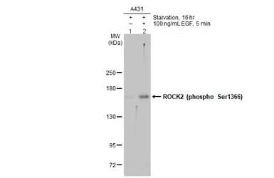 Anti-ROCK2 (phospho S1366) antibody(AB228008)