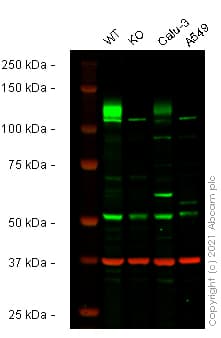 Anti-ACE2 antibody(AB15348)