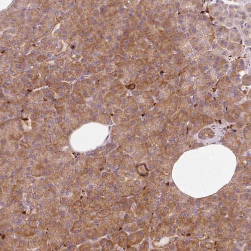 Iqgap2 Antibody Ab204225  Immunohistochemistry Formalin Pfa Fixed Paraffin Embedded Sections Img21079
