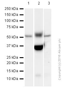 Anti-MMP3 antibody [EP1186Y](AB52915)