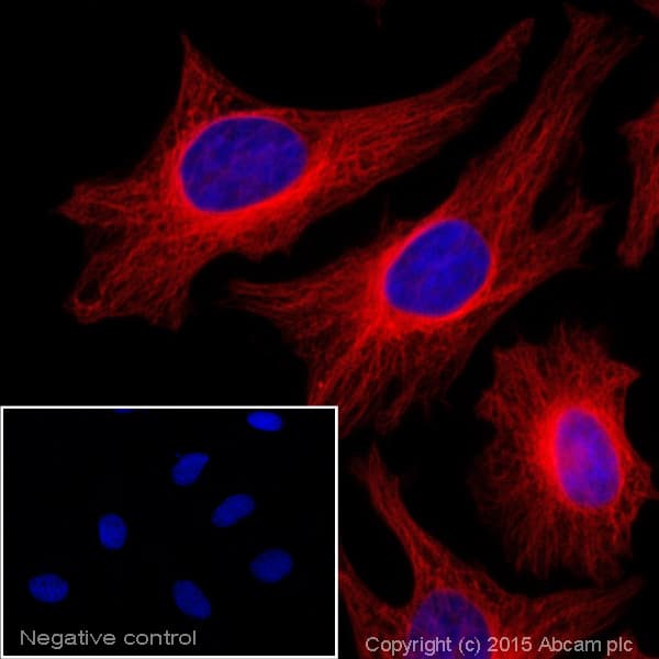 Goat Anti-Mouse IgG H&L (Alexa Fluor® 647)(AB150115)