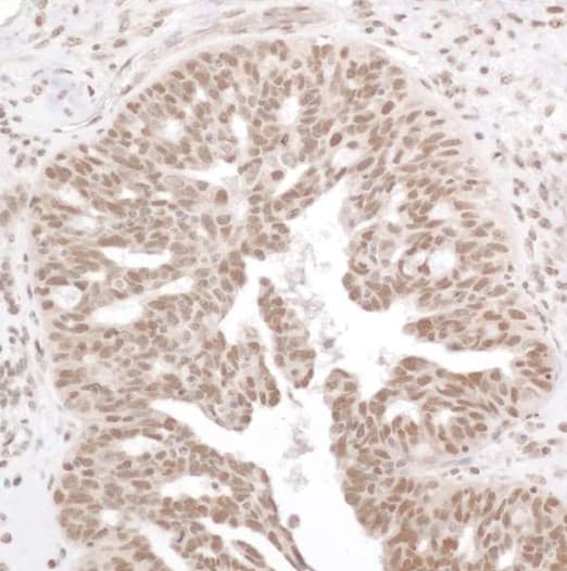 Anti-NF-kB p65 (phospho S536) antibody(AB86299)