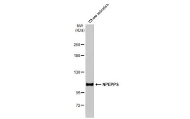 Npepps Antibody Hl1531 Ab308163  Western Blot Img407059