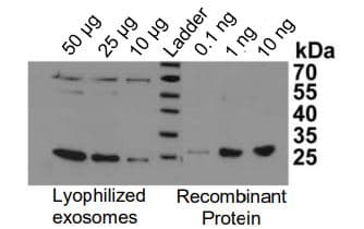 Overall Exosome Capture and Quantification Assay Kit(ab287851)