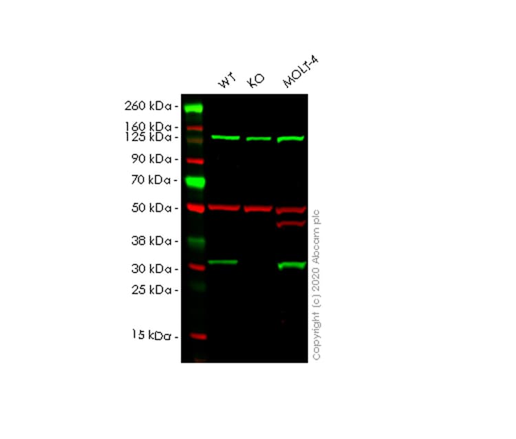 Anti-CNOT7 antibody [EPR18722](AB195587)