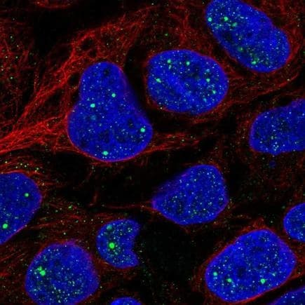 Anti-FAM123B antibody(AB221578)