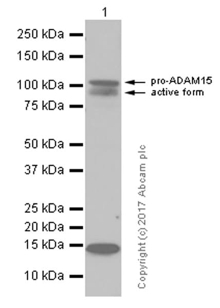 Anti-ADAM15 antibody [EPR5619](AB124698)