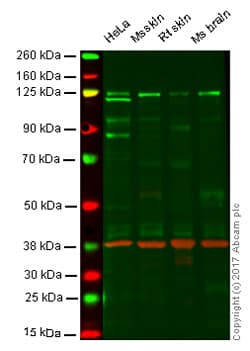 Anti-Dnmt3a antibody [EPR18455](AB188470)