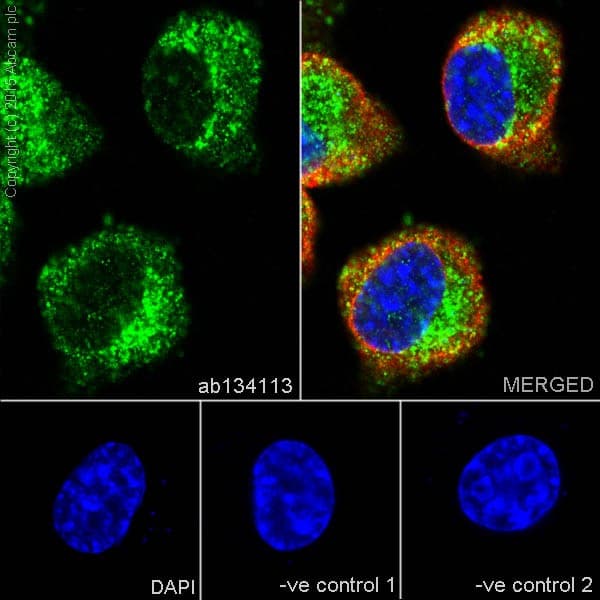 Anti-Niemann Pick C1 antibody [EPR5209] - BSA and Azide free(AB224268)