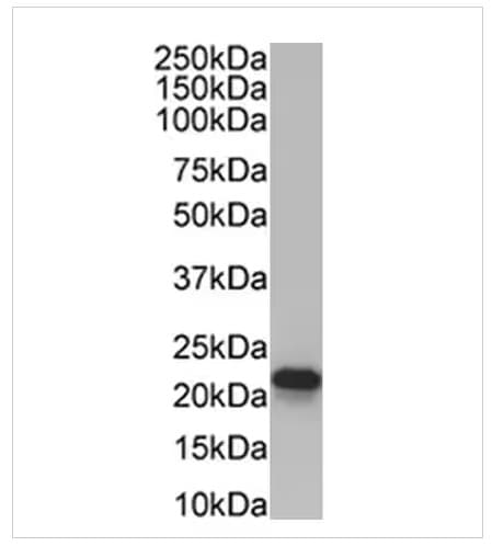 Alexa Fluor® 647 Anti-TBR2 / Eomes antibody [EPR19012](AB315356)