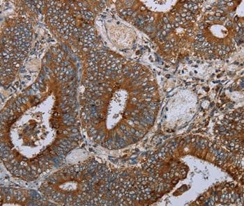 Maff Antibody Ab198249  Immunohistochemistry Formalin Pfa Fixed Paraffin Embedded Sections Img38603