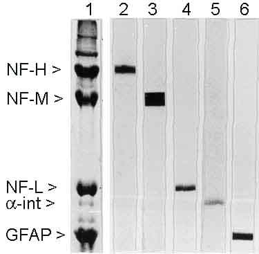 68kda Neurofilament Nf L Antibody Da2 Ab7255  Western Blot Img16830